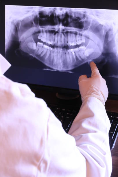 Best After-Hours Dental Trauma Care in Rson, CA