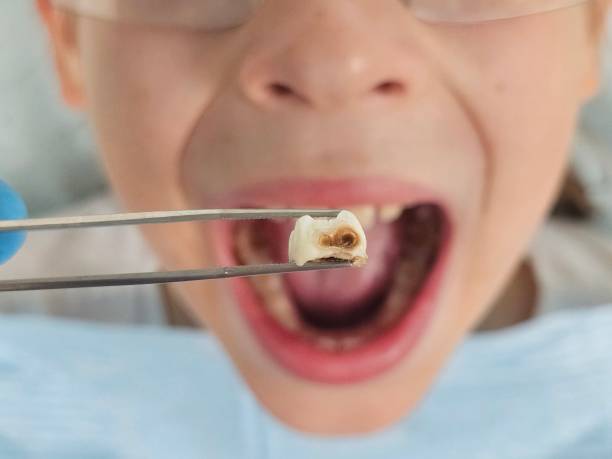 Best Weekend Emergency Dentist in Rson, CA